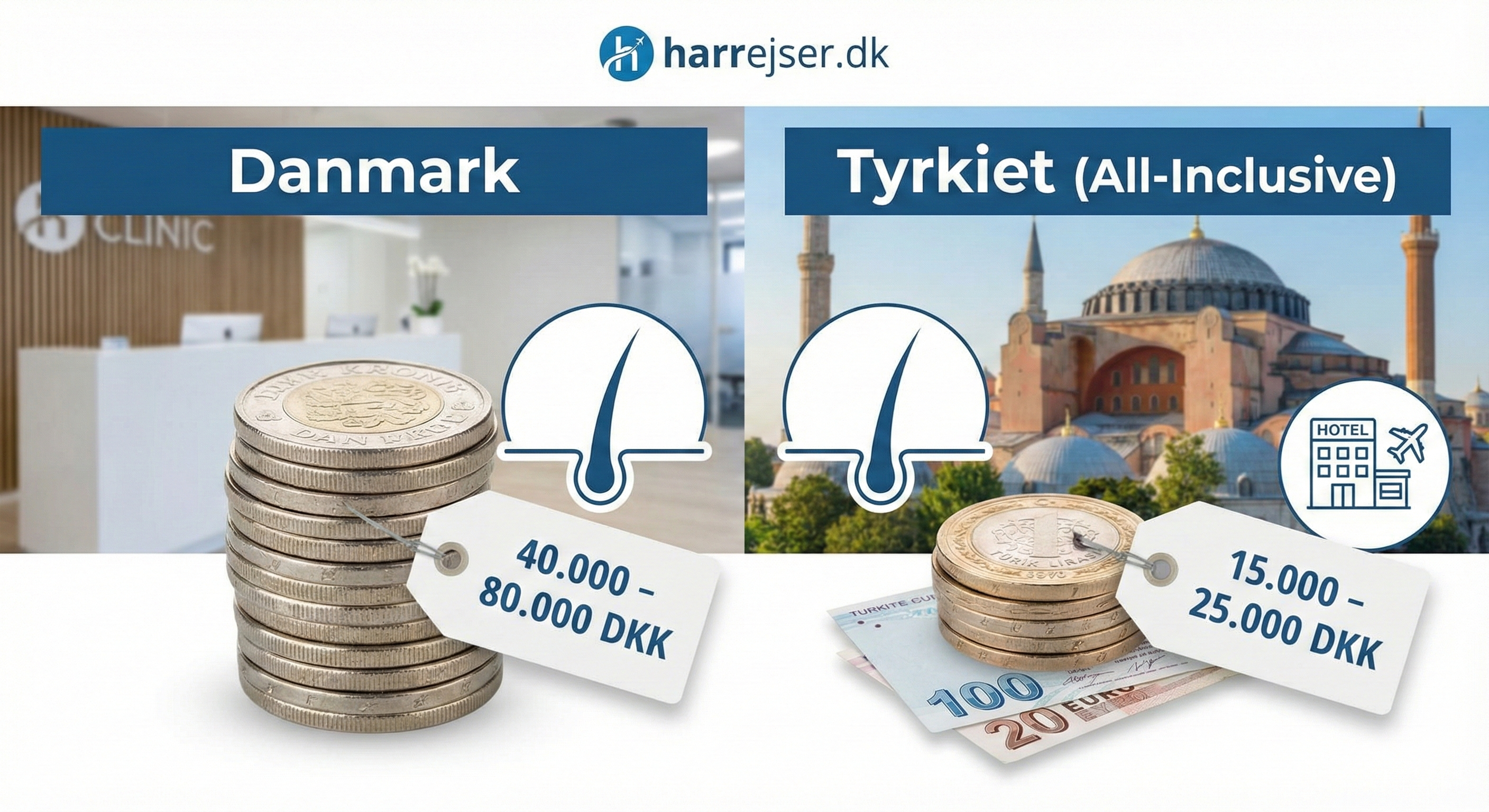 Hvad koster en Hårtransplantation i Tyrkiet? Komplet Prisguide